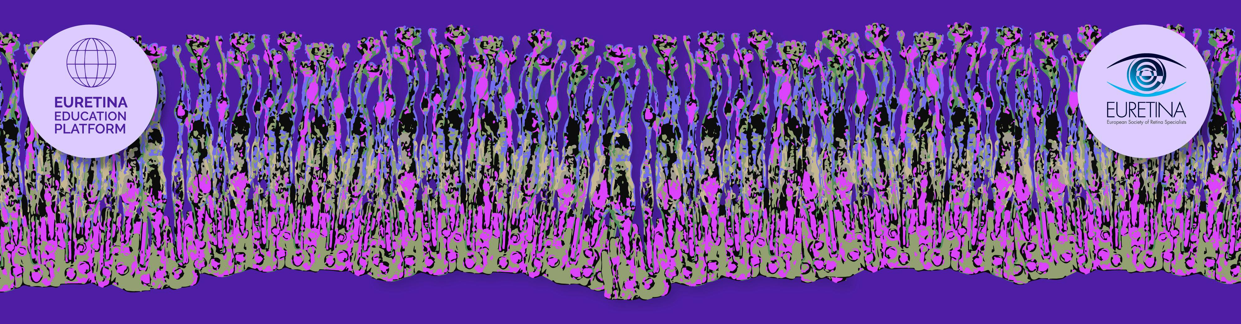 diagnosis-and-monitoring-of-atrophy-retina-today